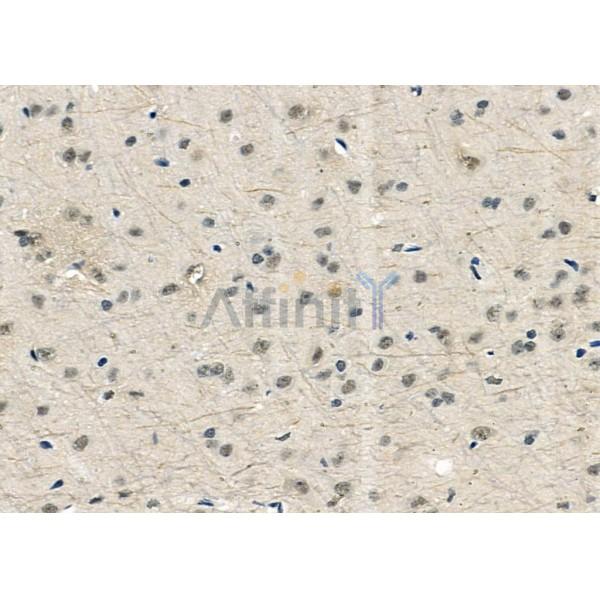 USP16 Antibody - DF9983 at 1/100 staining Rat brain tissue by IHC-P.