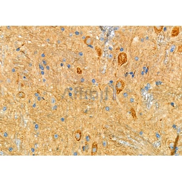 ANP32C Antibody - AF0326 at 1/100 staining Mouse brain tissue by IHC-P.
