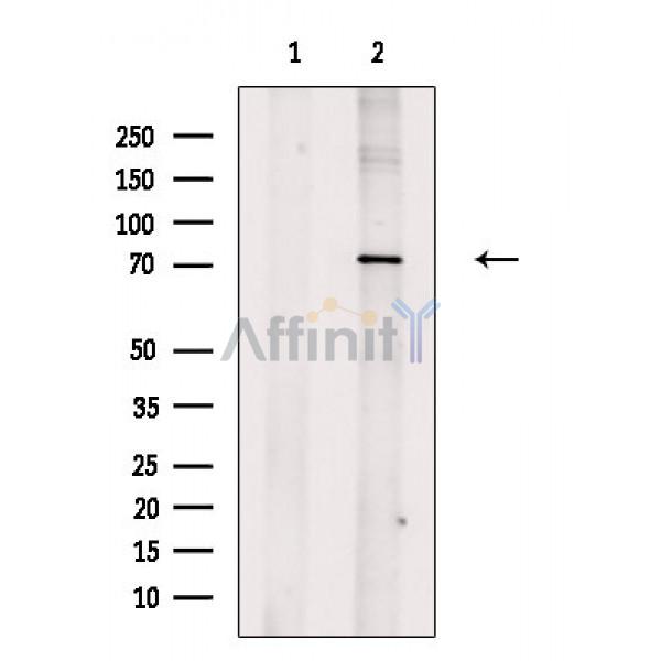 TNAP2 Antibody - Western blot analysis of extracts from VERO cells(H2O2 treatment), using TNAP2 Antibody.