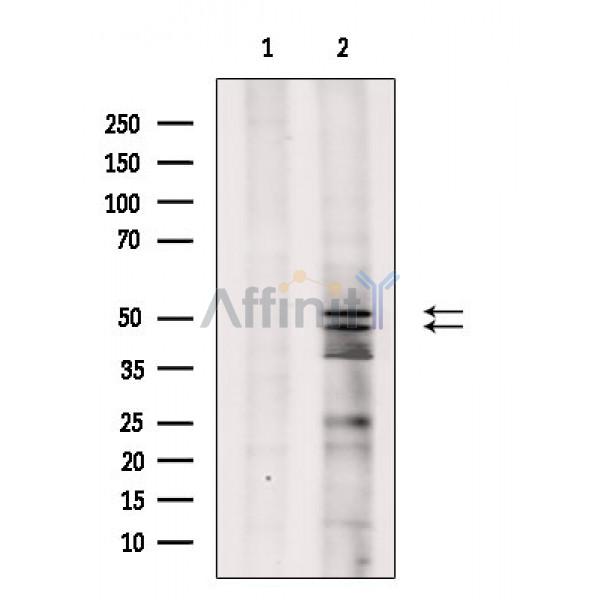 Phospho-JNK1/2/3 (Thr183+Tyr185) Antibody - Western blot analysis of extracts from Rat lung, using Phospho-JNK1/2/3 (Thr183+Tyr185) Antibody.