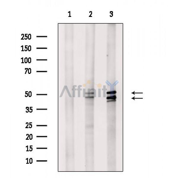 Phospho-JNK1/2/3 (Thr183+Tyr185) Antibody - Western blot analysis of extracts from various samples, using Phospho-JNK1/2/3 (Thr183+Tyr185) Antibody.