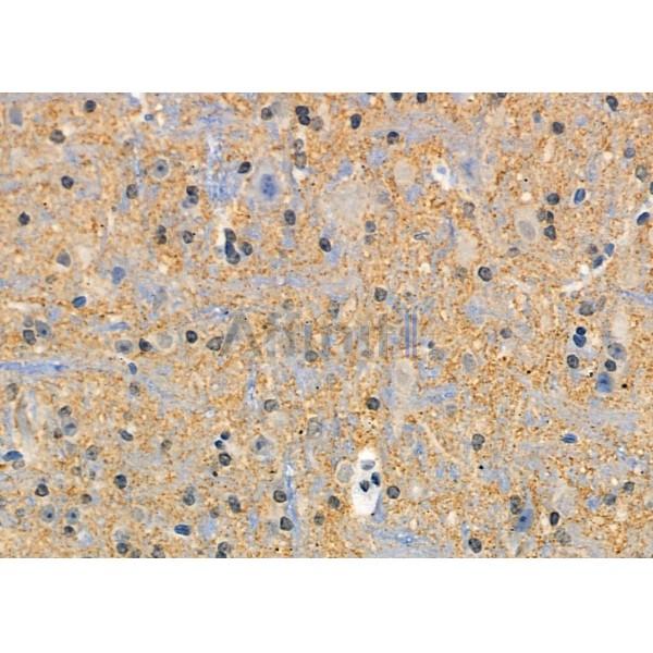 Synapsin I Antibody - AF6201 at 1/100 staining Mouse brain tissue by IHC-P.