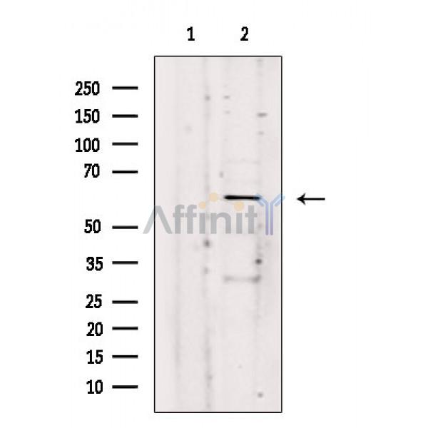 Arylsulfatase K Antibody - Western blot analysis of extracts from Mouse brain, using Arylsulfatase K Antibody.