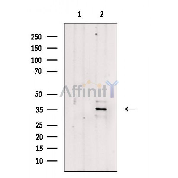 FoxR1 Antibody - Western blot analysis of extracts from Rat liver, using FoxR1 Antibody.