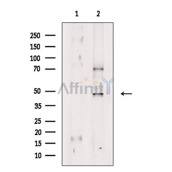 GRIN2 Antibody - Western blot analysis of extracts from VERO cells(H2O2 treatment), using GRIN2 Antibody.