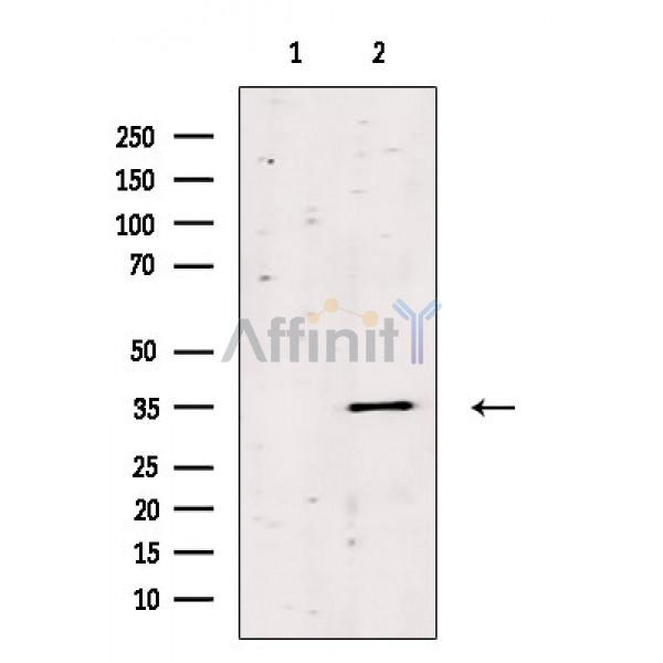 Olfactory receptor 13C8 Antibody - Western blot analysis of extracts from HepG2 cells(heat shock treatment), using Olfactory receptor 13C8 Antibody.