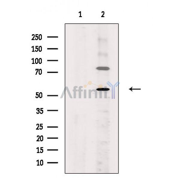 ZNF577 Antibody - Western blot analysis of extracts from VERO cells(H2O2 treatment), using ZNF577 Antibody.