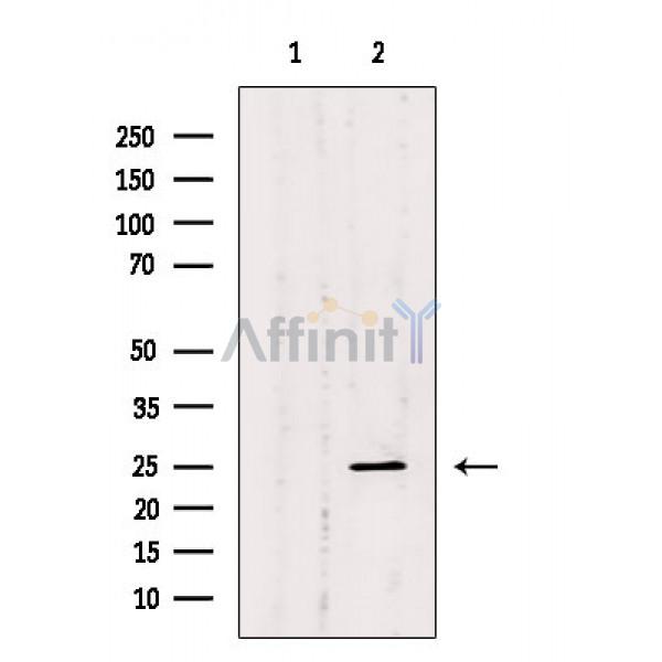 GH1 Antibody - Western blot analysis of extracts from COLO205 cells, using GH1 Antibody.