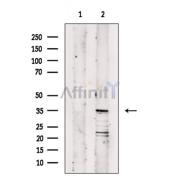 OR11A1 Antibody - Western blot analysis of extracts from Rat testis, using OR11A1 Antibody.