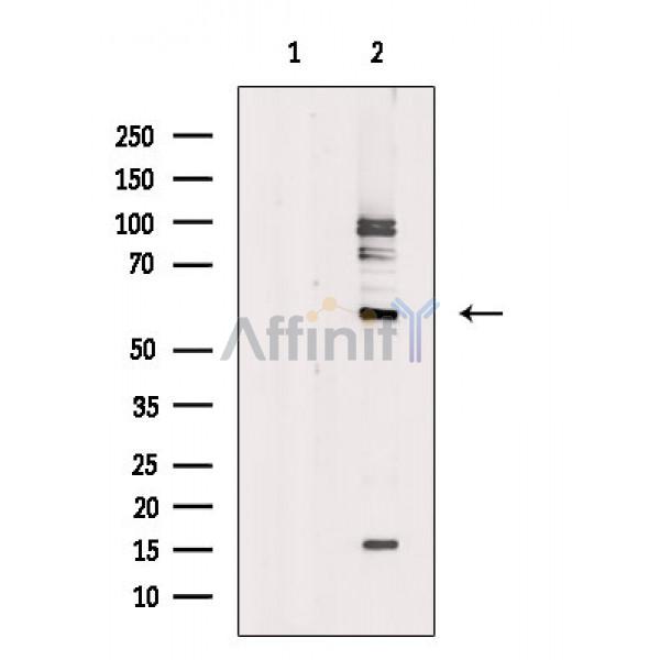 NOC4L Antibody - Western blot analysis of extracts from COLO205 cells, using NOC4L Antibody.
