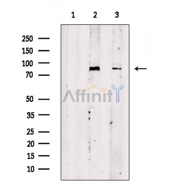 TB10B Antibody - Western blot analysis of extracts from various samples, using TB10B Antibody.