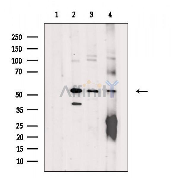 ZNF71 Antibody - Western blot analysis of extracts from various samples, using ZNF71 Antibody.