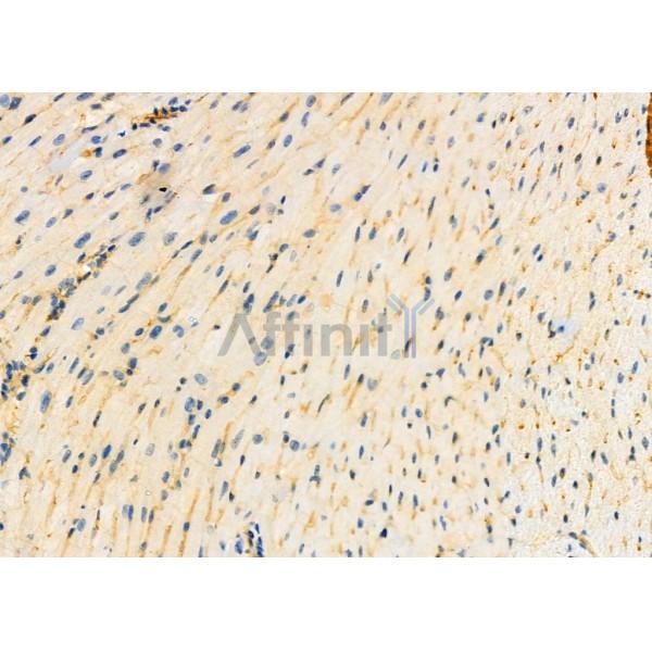 C10orf63 Antibody - DF2906 at 1/100 staining Mouse heart tissue by IHC-P.