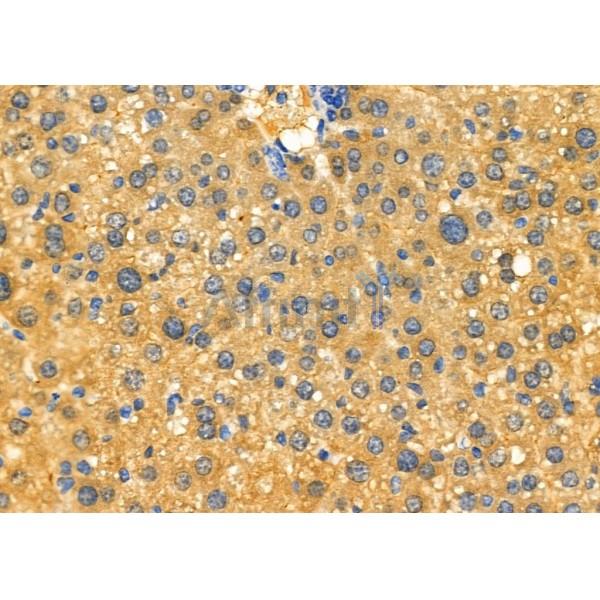 C10orf63 Antibody - DF2906 at 1/100 staining Mouse liver tissue by IHC-P.