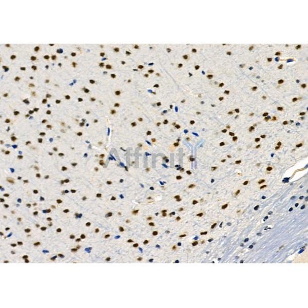 PTBP2 Antibody - DF2956 at 1/100 staining Mouse brain tissue by IHC-P.