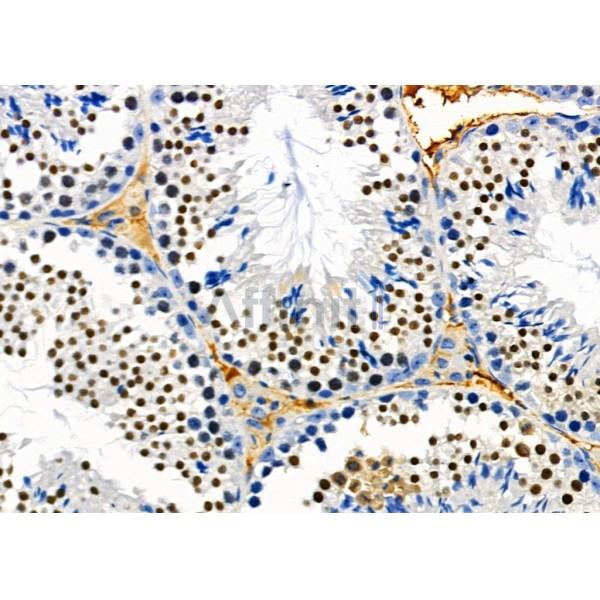 PTBP2 Antibody - DF2956 at 1/100 staining Mouse testis tissue by IHC-P.