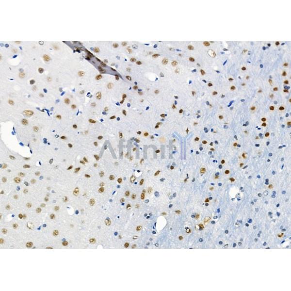 PTBP2 Antibody - DF2956 at 1/100 staining Rat brain tissue by IHC-P.