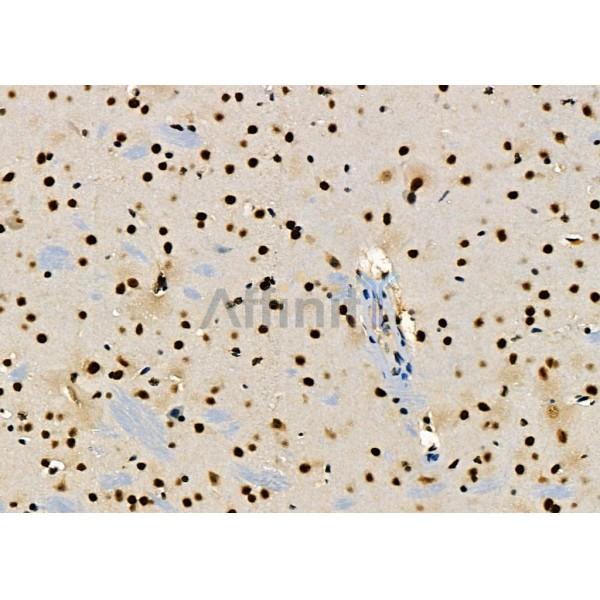 KAP1 Antibody - DF3150 at 1/100 staining Mouse brain tissue by IHC-P.
