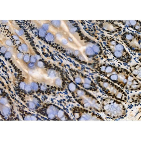 KAP1 Antibody - DF3150 at 1/100 staining Mouse colorectal tissue by IHC-P.
