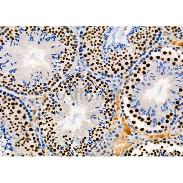 KAP1 Antibody - DF3150 at 1/100 staining Mouse testis tissue by IHC-P.