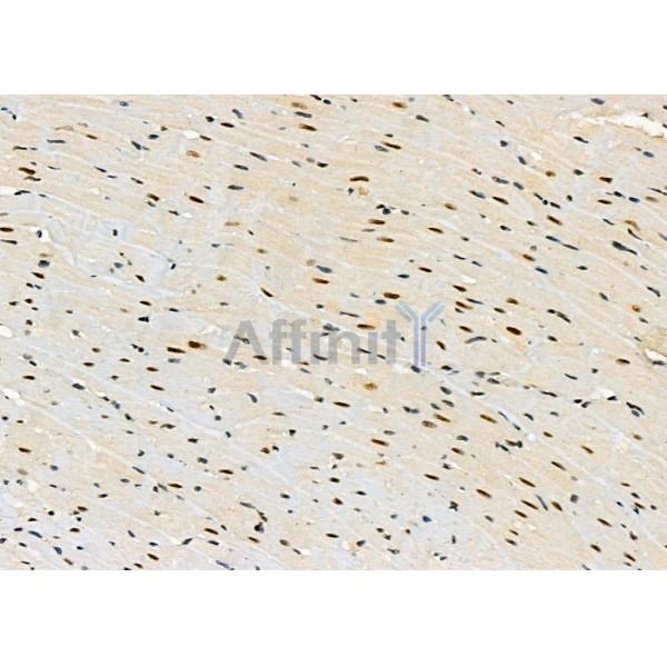 KAP1 Antibody - DF3150 at 1/100 staining Rat heart tissue by IHC-P.