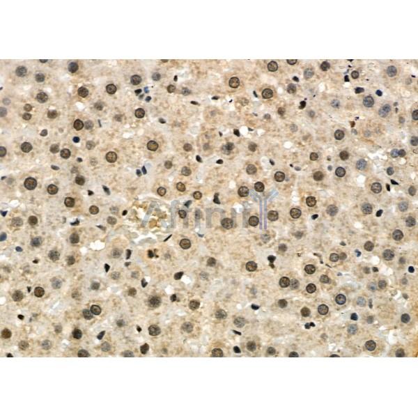 KAP1 Antibody - DF3150 at 1/100 staining Rat liver tissue by IHC-P.