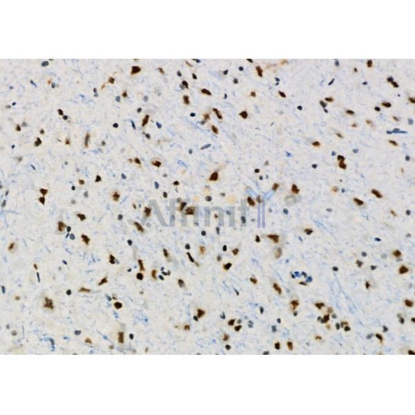 KAP1 Antibody - DF3150 at 1/100 staining Rat brain tissue by IHC-P.