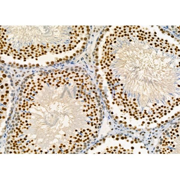 KAP1 Antibody - DF3150 at 1/100 staining Rat testis tissue by IHC-P.