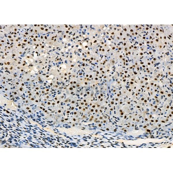 KAP1 Antibody - DF3150 at 1/100 staining Rat ovarian tissue by IHC-P.