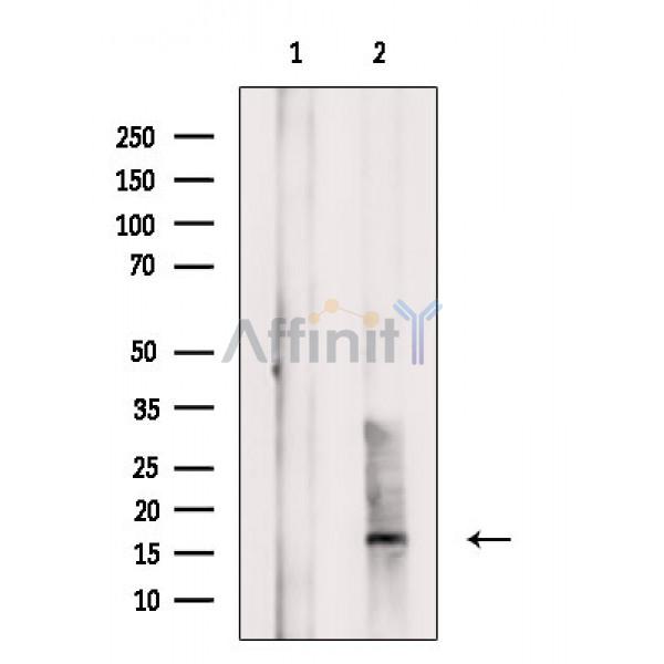 CD160 Antibody - Western blot analysis of extracts from Mouse spleen, using CD160 Antibody.