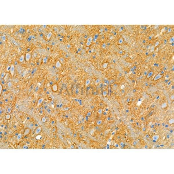 CDCA3 Antibody - DF3544 at 1/100 staining Mouse brain tissue by IHC-P.