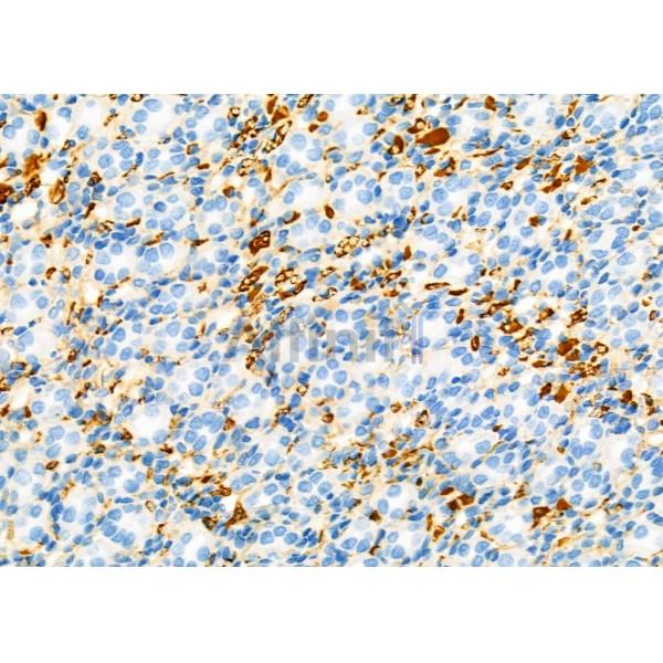 CDCA3 Antibody - DF3544 at 1/100 staining Rat kidney tissue by IHC-P.