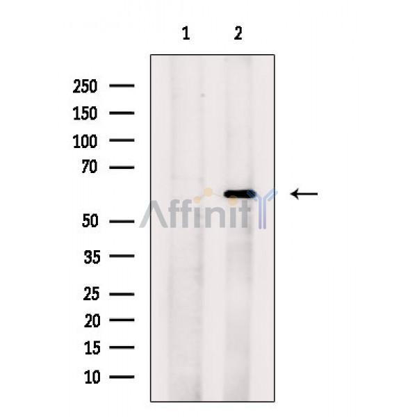 CDK5RAP3 Antibody - Western blot analysis of extracts from VERO cells(H2O2 treatment), using CDK5RAP3 Antibody.