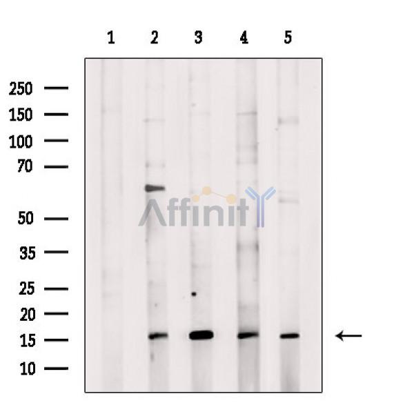 CYTL1 Antibody - Western blot analysis of extracts from various samples, using CYTL1 Antibody.