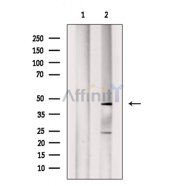 ABHD12 Antibody - Western blot analysis of extracts from VERO cells(H2O2 treatment), using ABHD12 Antibody.