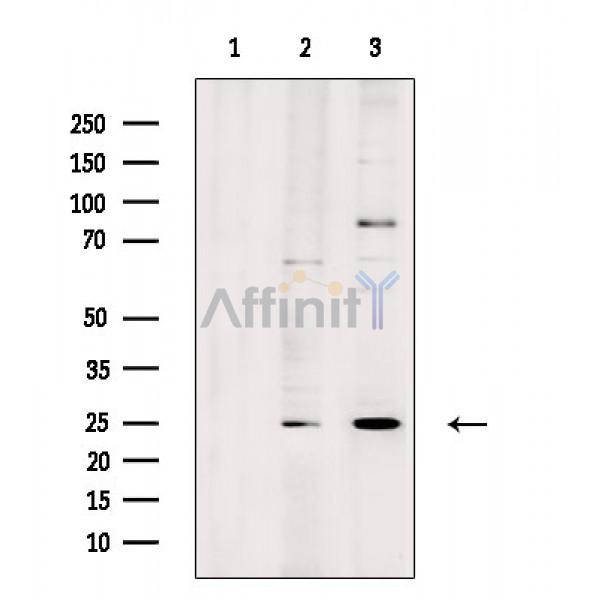 LYPLA1 Antibody - Western blot analysis of extracts from various samples, using LYPLA1 Antibody.