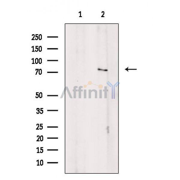 AMPH Antibody - Western blot analysis of extracts from Hela cells, using AMPH Antibody.