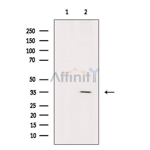 ATPAF2 Antibody - Western blot analysis of extracts from VERO cells(1hUV treatment), using ATPAF2 Antibody.