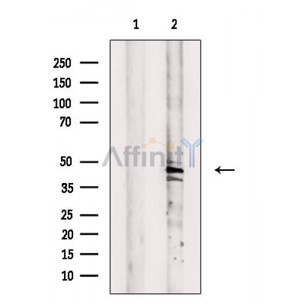 GCNT6 Antibody - Western blot analysis of extracts from Mouse liver, using GCNT6 Antibody.