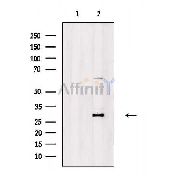 Carbonic Anhydrase 1/CA1 Antibody - Western blot analysis of extracts from Rat muscle, using Carbonic Anhydrase 1/CA1 Antibody.
