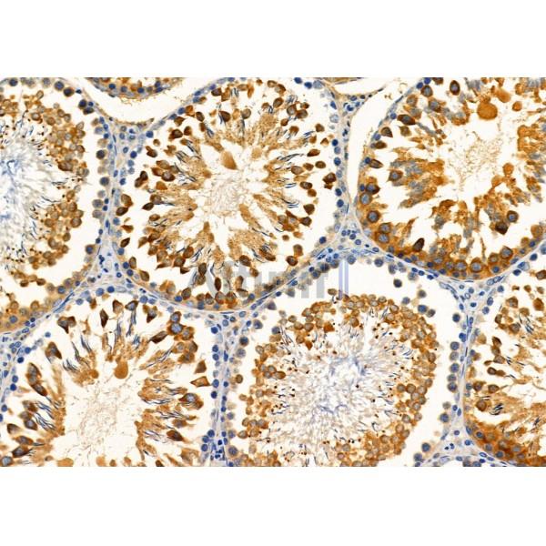 KCNK12 Antibody - DF4306 at 1/100 staining Rat testis tissue by IHC-P.