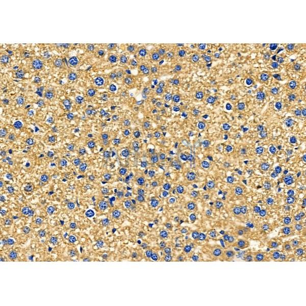 KCNK4 Antibody - DF4309 at 1/100 staining Mouse liver tissue by IHC-P.