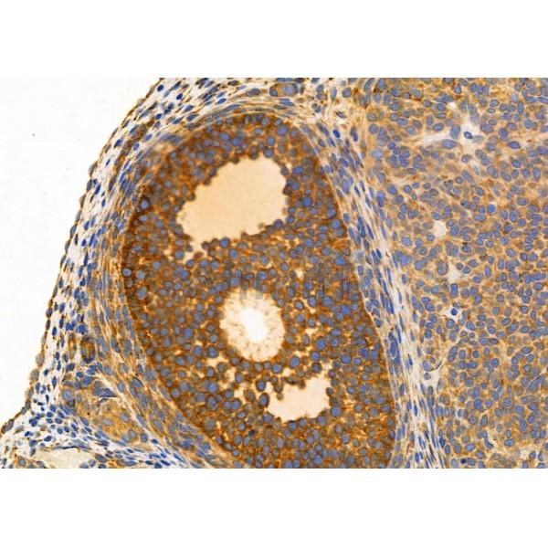 KCNA5 Antibody - DF4313 at 1/100 staining Rat ovarian tissue by IHC-P.