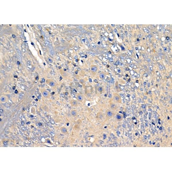 KCNF1 Antibody - DF4316 at 1/100 staining Mouse brain tissue by IHC-P.