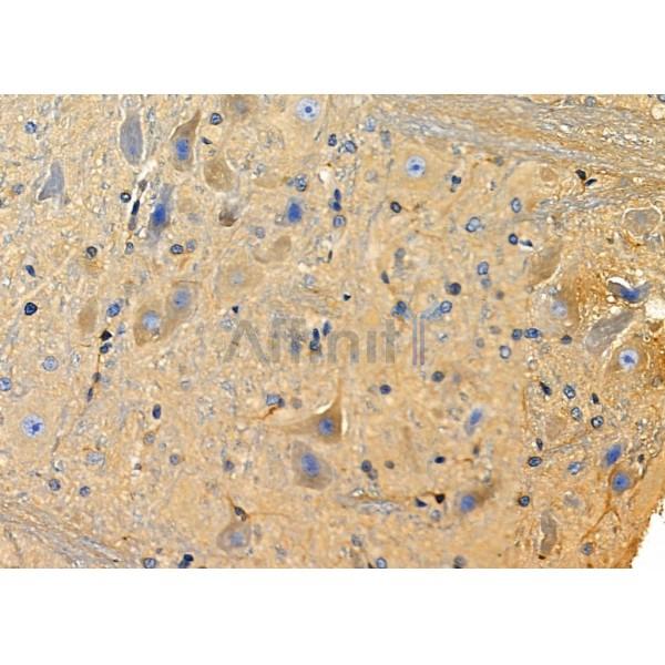 KCNF1 Antibody - DF4316 at 1/100 staining Rat brain tissue by IHC-P.