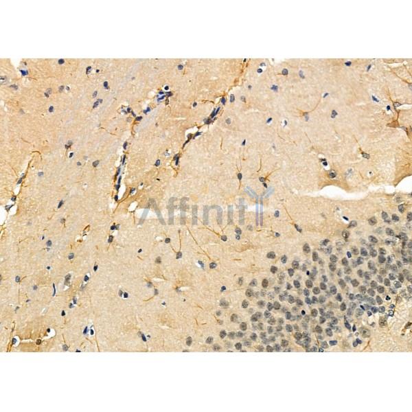 KCNH1 Antibody - DF4319 at 1/100 staining Rat brain tissue by IHC-P.
