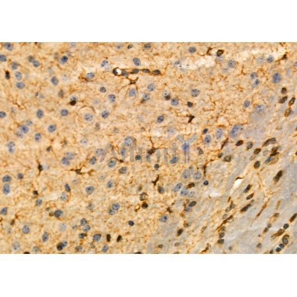 KCNH3 Antibody - DF4320 at 1/100 staining Mouse brain tissue by IHC-P.