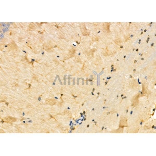 KCNH3 Antibody - DF4320 at 1/100 staining Rat brain tissue by IHC-P.