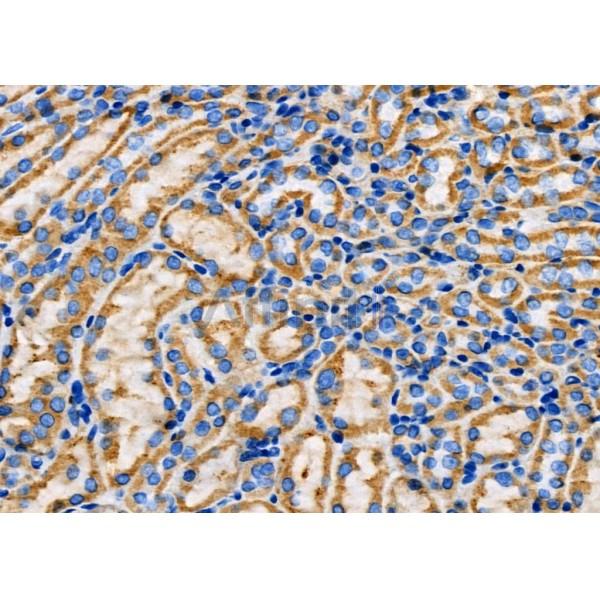SPINK5 Antibody - DF4462 at 1/100 staining Mouse kidney tissue by IHC-P.