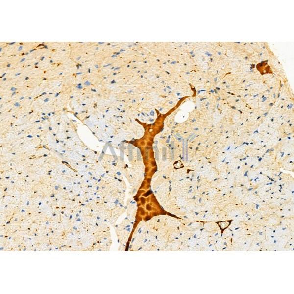 CRP Antibody - DF6027 at 1/100 staining Mouse heart tissue by IHC-P.